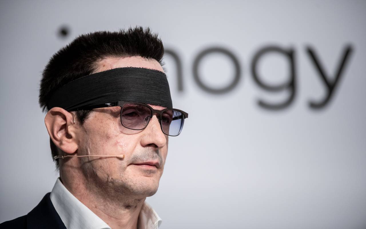 Innogy Finanzchef Bernhard Günther nach Säureanschlag