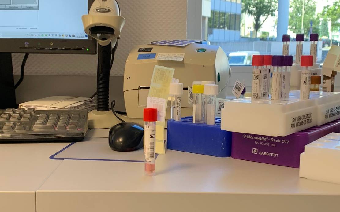 Testprobe beim Eingang