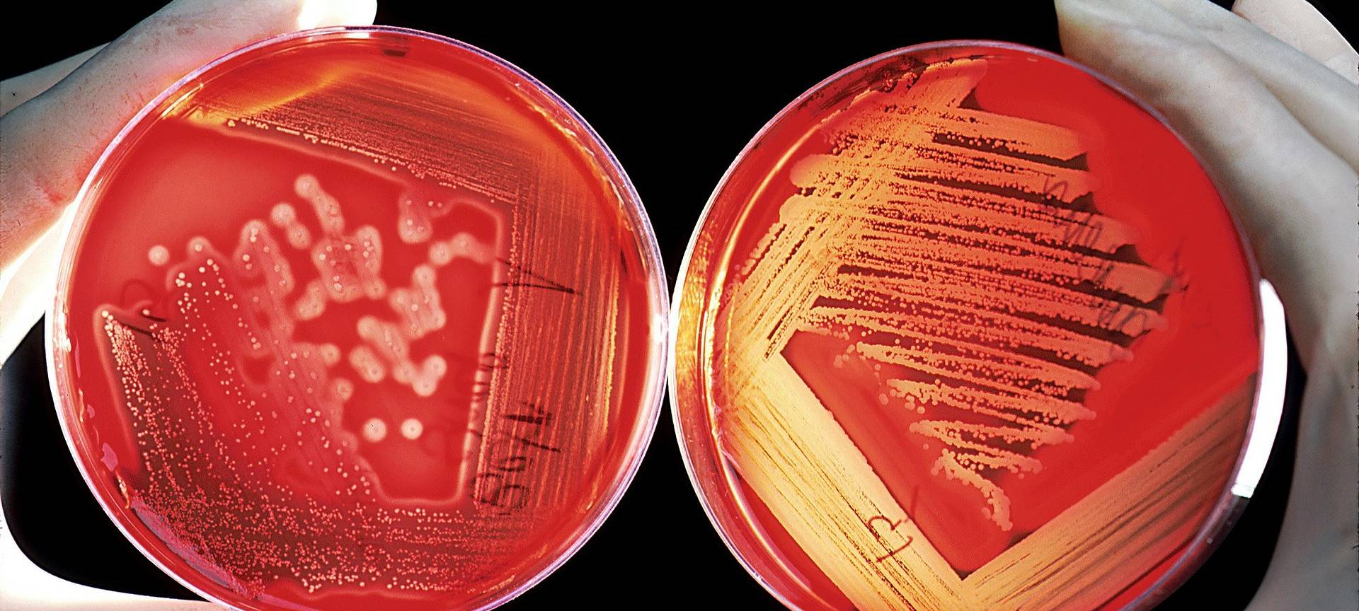 Uniklinik Essen: Reaktionen auf Keime im Trinkwasser