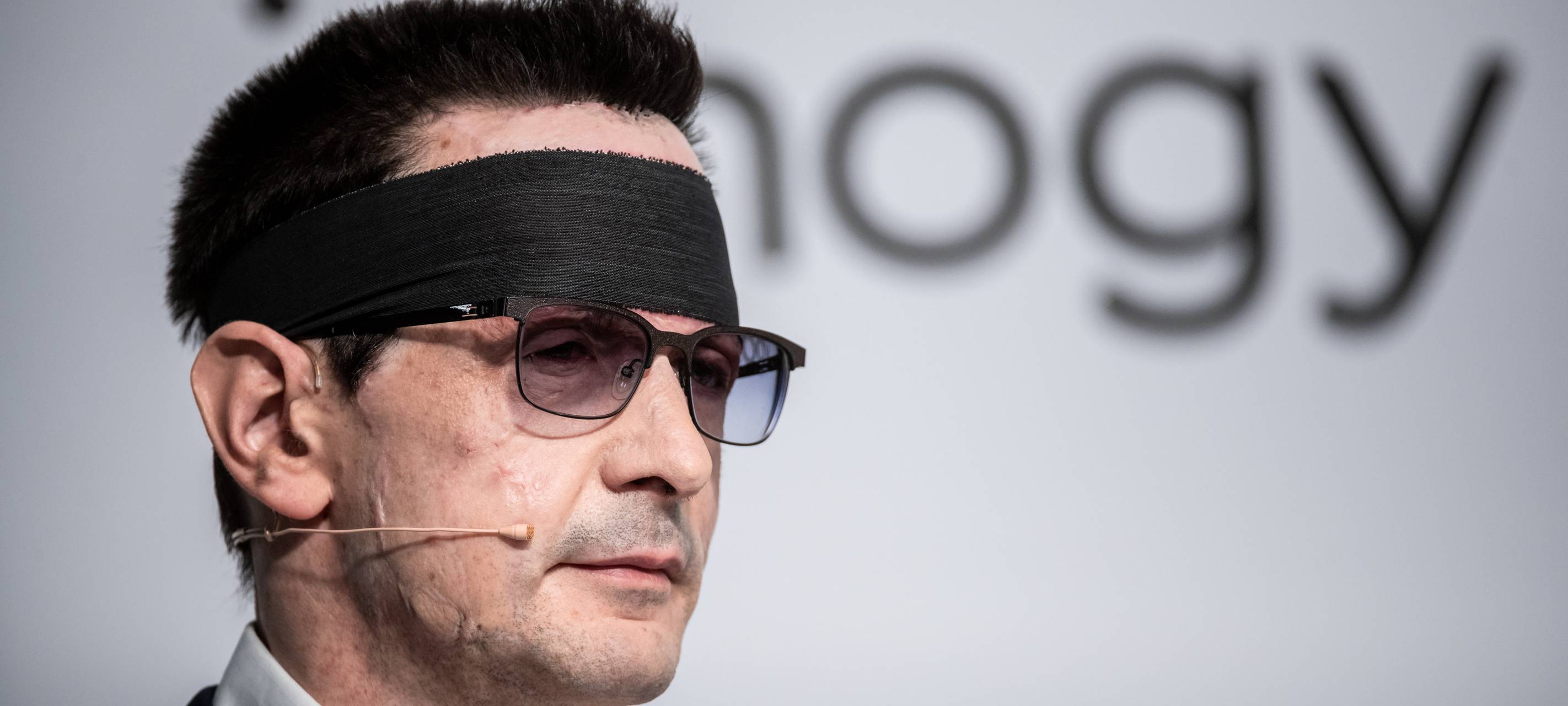 Innogy Finanzchef Bernhard Günther nach Säureanschlag