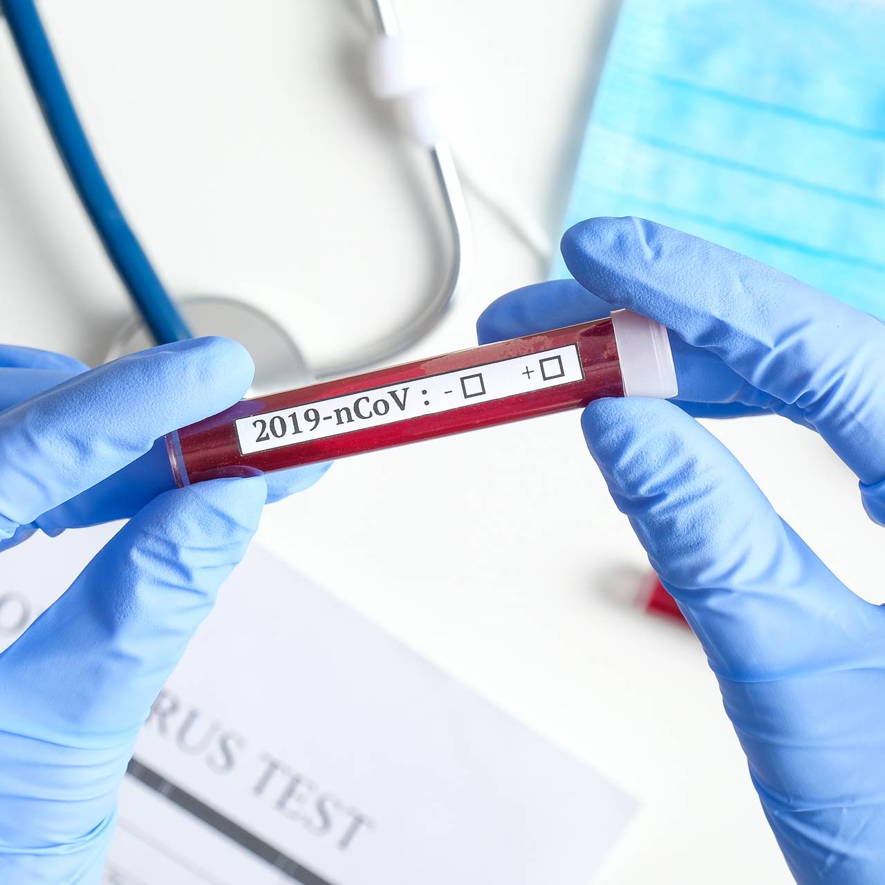 Ein Test für das Krankheitsbild des 2019-nCoV (Symbolbild).