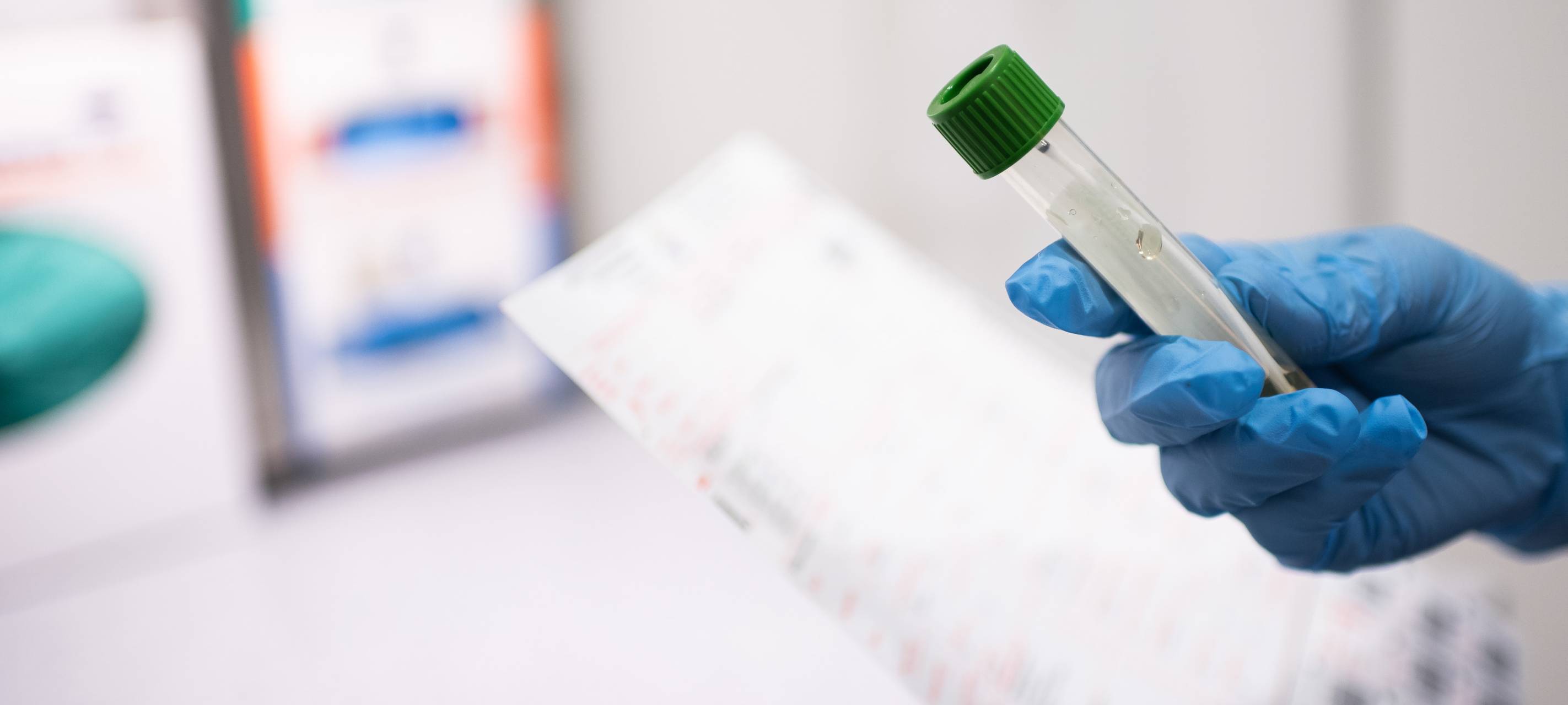 Universitätsklinik Essen Virologie Röhrchen Labor Essen Symbolbild Corona-virus coronavirus