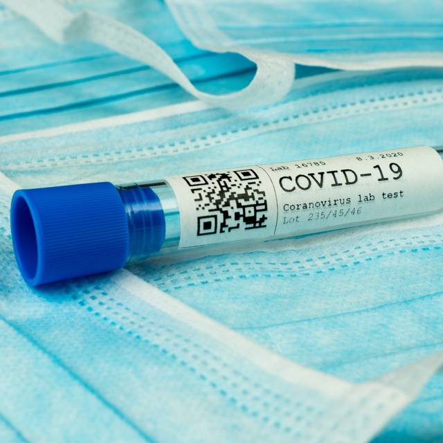 Ein Labortest-Röhrchen mit der Beschriftung COVID-19 Coronavirus Labortest liegt auf Schutzmasken.