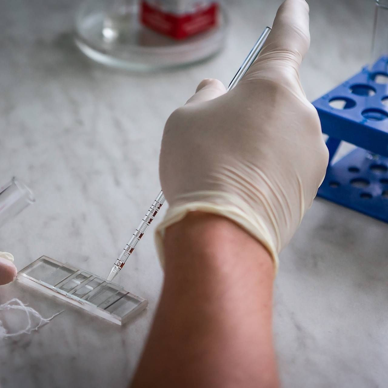 Laboruntersuchungen auf das Vorhandensein von Coronavirus COVID-19. Bluttest im Krankenhaus. Medizinische Ausrüstung.