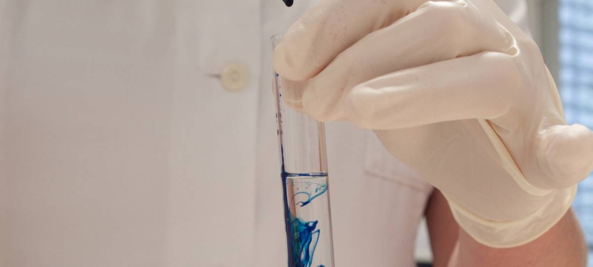 Coronavirus: Zwei weitere Todesfälle in Essen