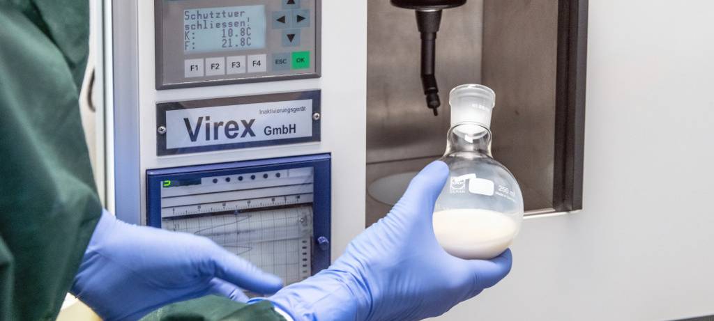 Muttermilch für Frühchen in Essen: Uniklinik startet Muttermilchbank