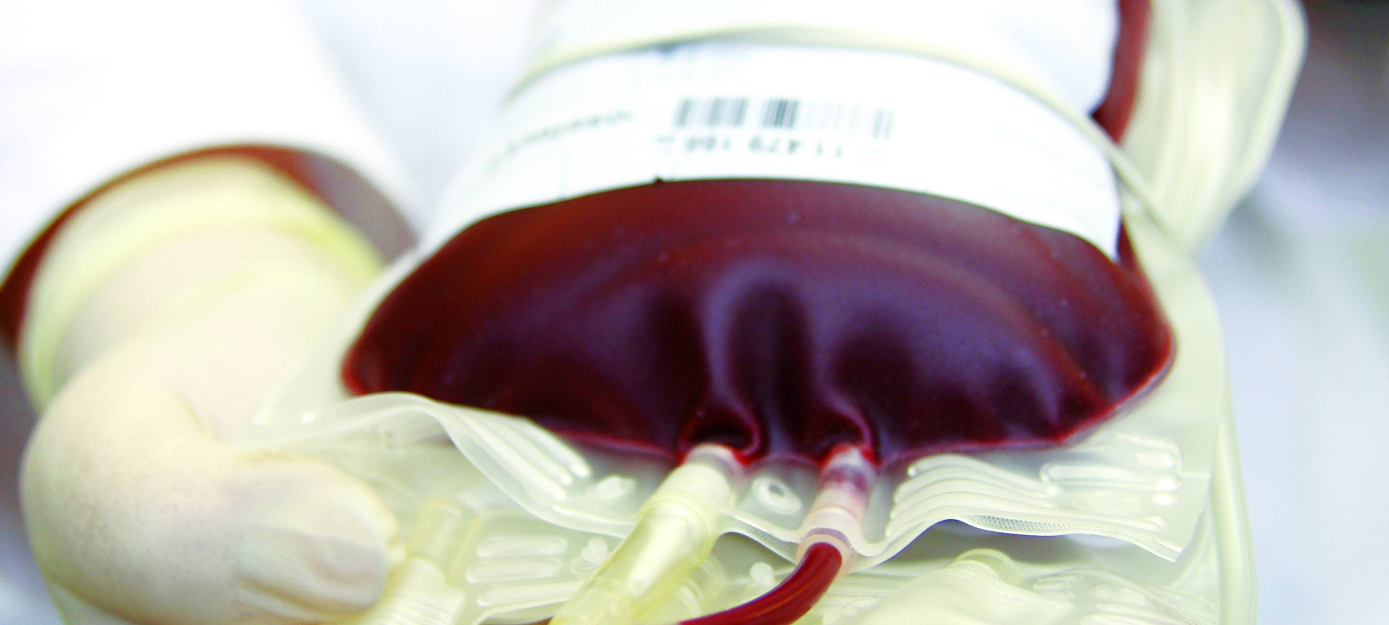 Blutspenden in Essen: Diese Regeln gelten