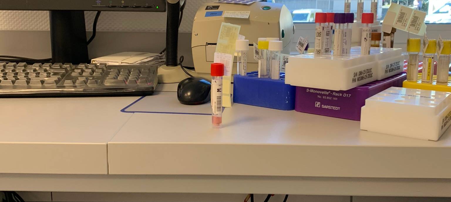 Testprobe beim Eingang