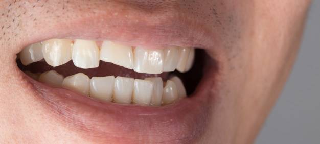 Zahn_Zähne_Gebiss_Radio Essen