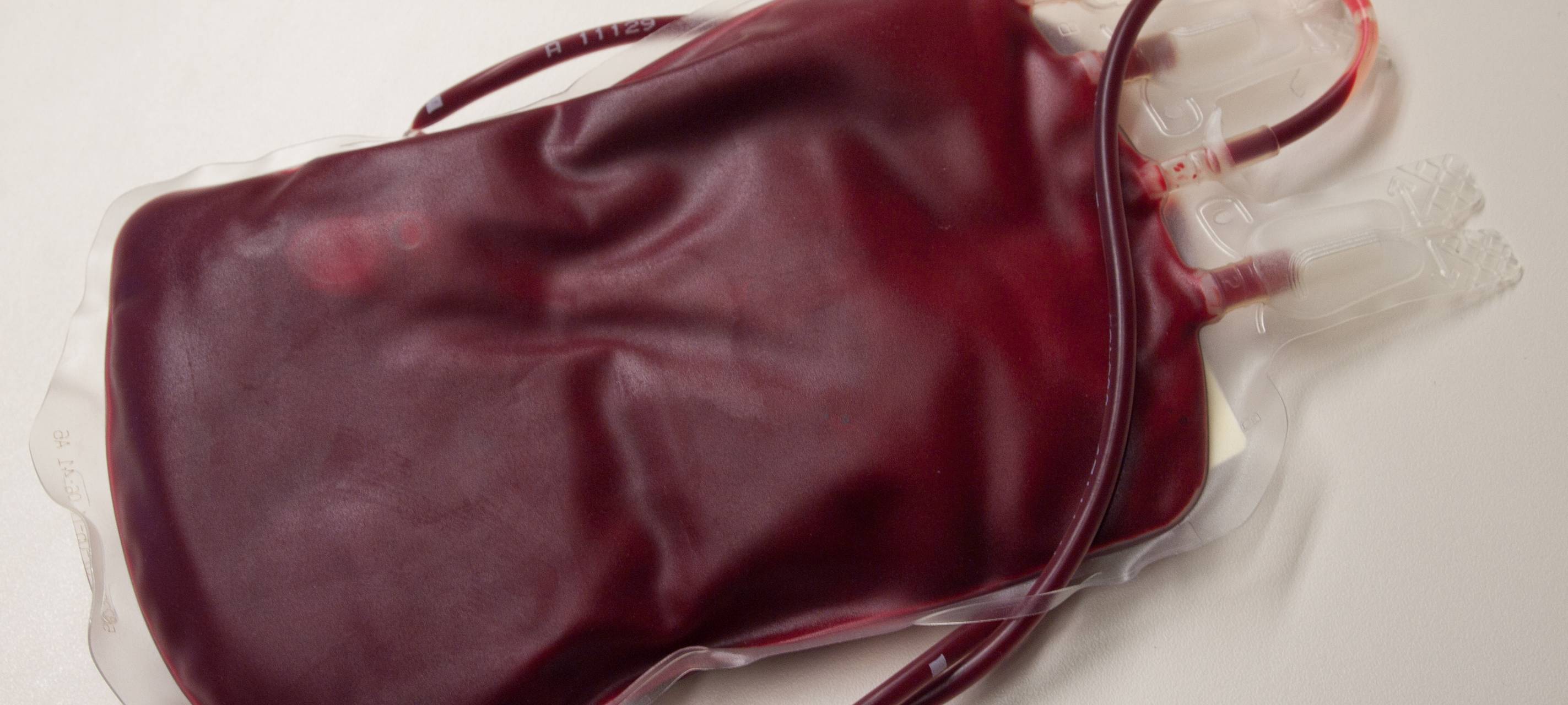 Blutspendezahlen in Essen gehen zurück