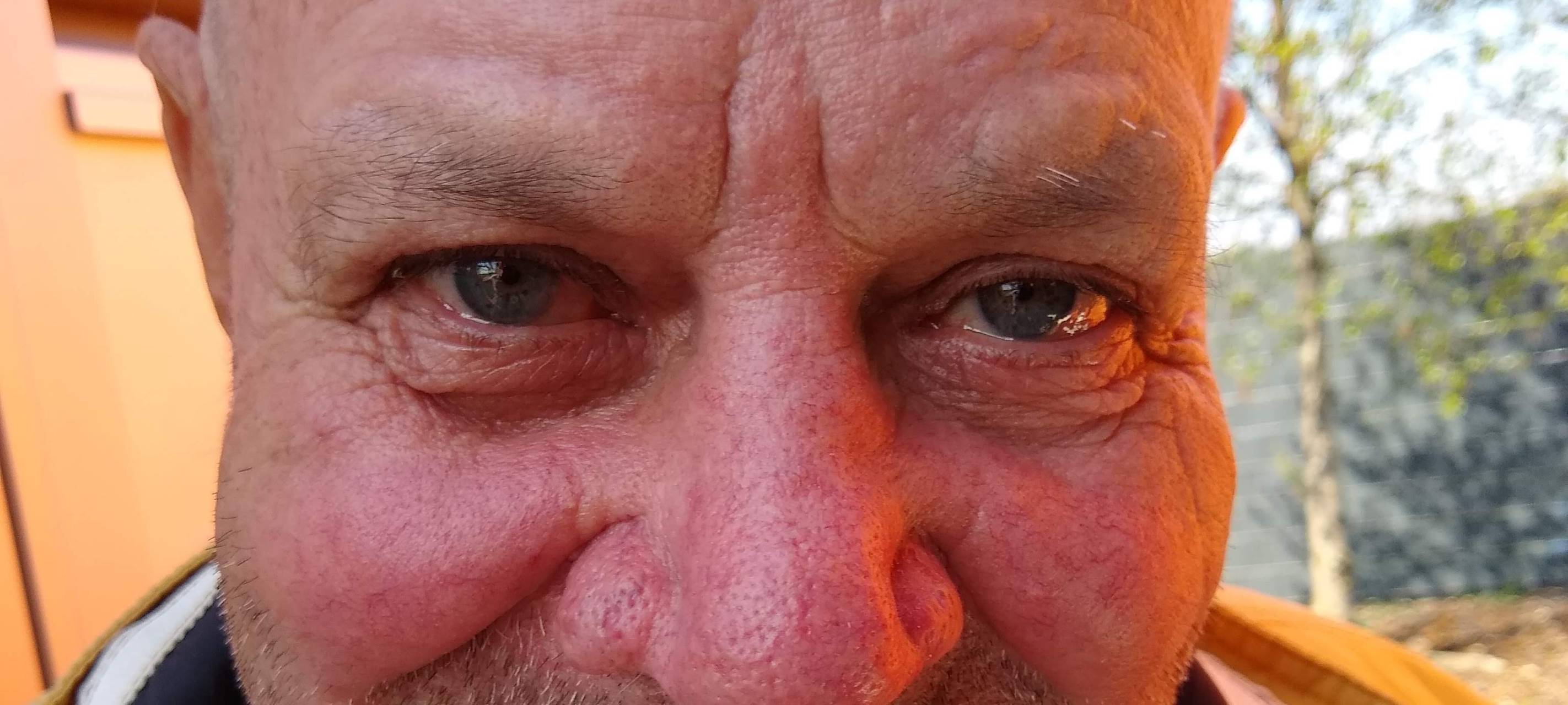 Polizei Essen sucht diesen Mann: Wer hat ihn gesehen?