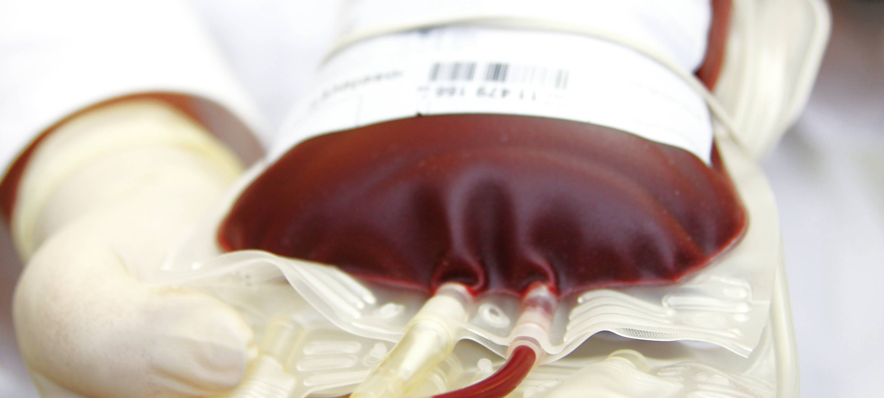 Long Covid in Essen: Auch hier viele erkrankt - Betroffene und Experten geben Einblicke