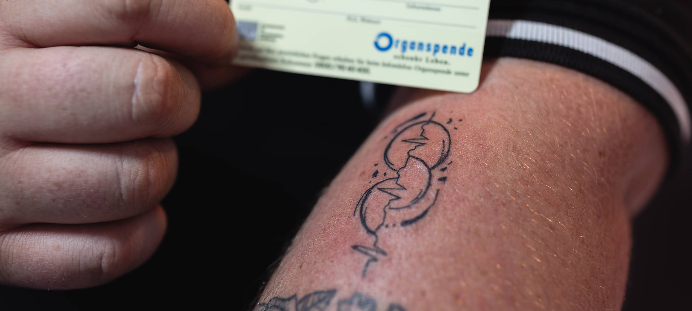 Organspende in Essen - Tattoo-Aktion in der Uniklink