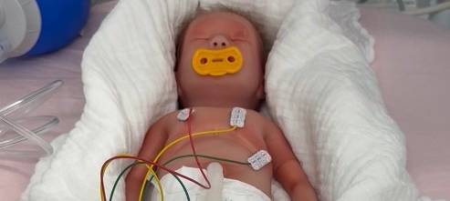 Spezialstation in Essen für Frühchen feiert Jubiläum