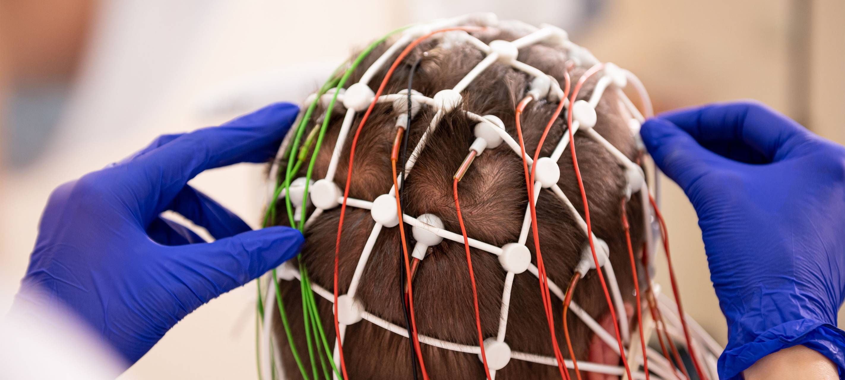 Neuro-Tag in Essen - Euer Blick in die Neurologie